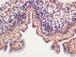 METTL11A Polyclonal Antibody